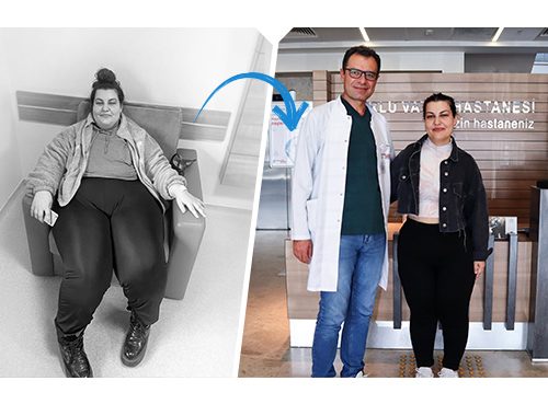 Yılan Yapısı 73684361