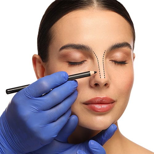 Yılan Yapısı 239199404