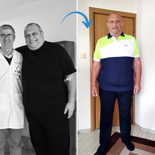 Yılan Yapısı 554954470