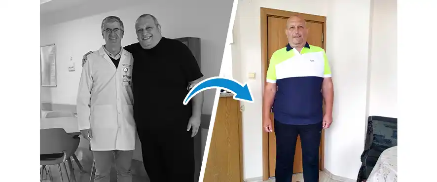 Our Patient Stories: Ferudun Bikmaz Lost 41 Kilograms with Bariatric Surgery!