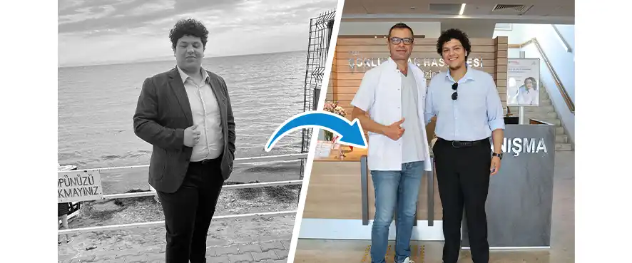 Our Patient Lost 47 Kilograms with Bariatric Surgery!