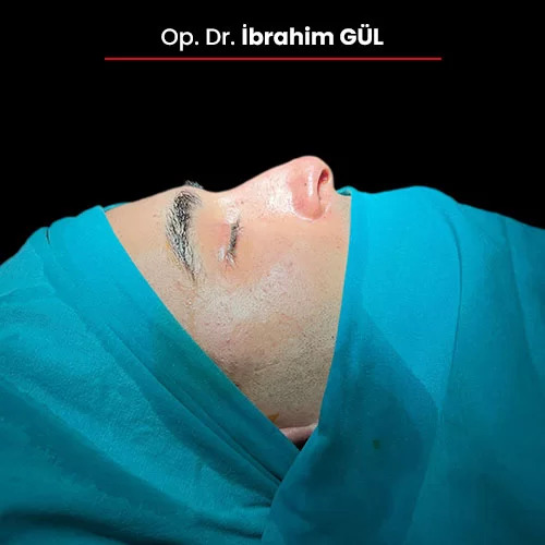 Öncesi Sonrası 330087669