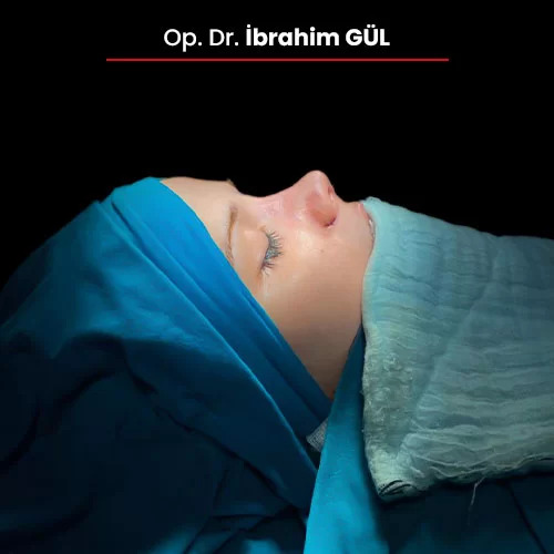 Öncesi Sonrası 1243783003