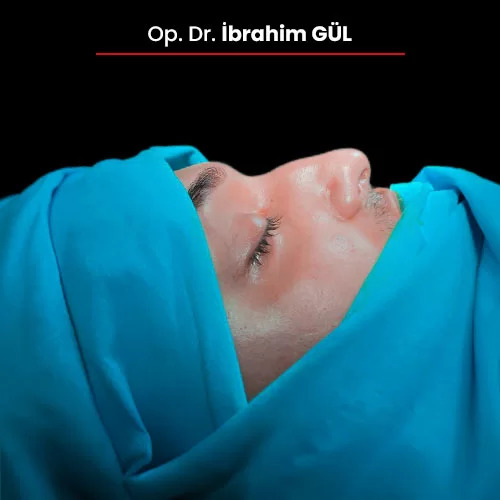 Öncesi Sonrası 1750617722