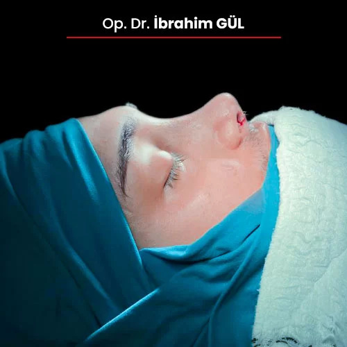 Öncesi Sonrası 1750617722