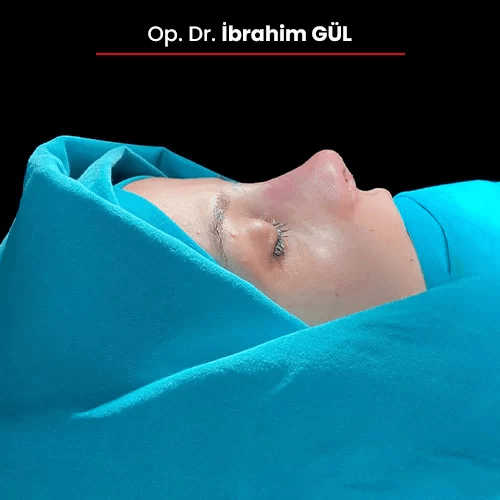 Öncesi Sonrası 1183372485