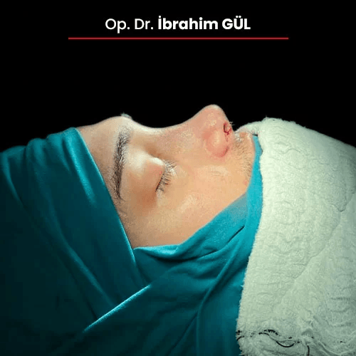 Öncesi Sonrası 1542984374