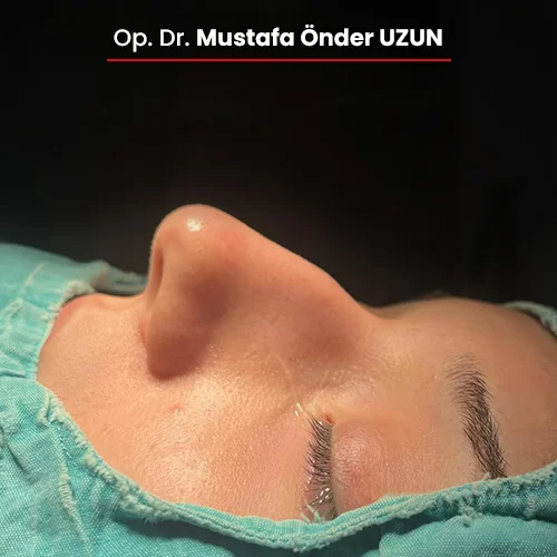 Öncesi Sonrası 640097056