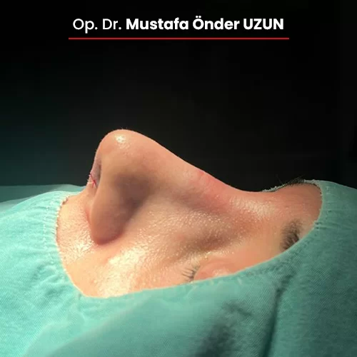 Öncesi Sonrası 640097056