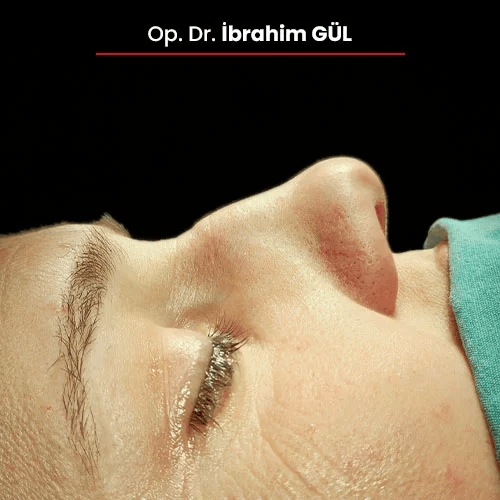 Öncesi Sonrası 1187456653