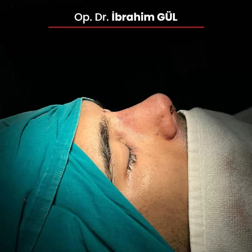 Öncesi Sonrası 1980589835