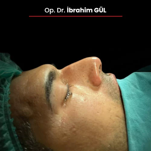 Öncesi Sonrası 1980589835