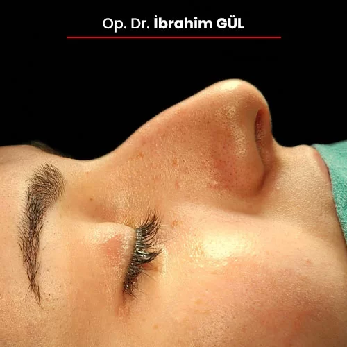 Öncesi Sonrası 1331535300