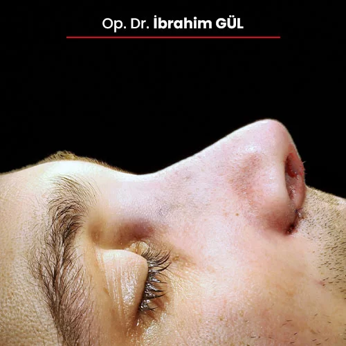 Öncesi Sonrası 2067463207