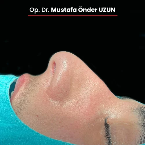 Öncesi Sonrası 289107363