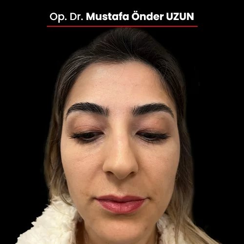 Öncesi Sonrası 1474708339