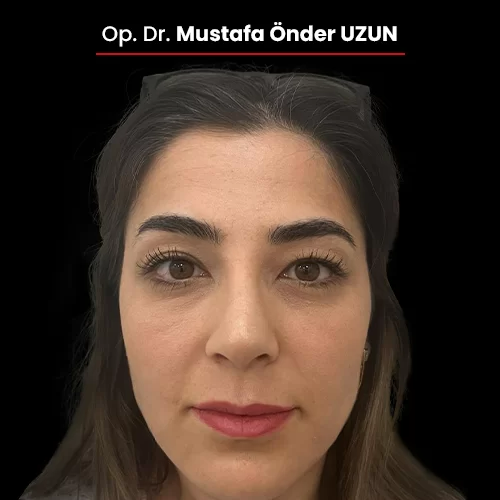 Öncesi Sonrası 1474708339