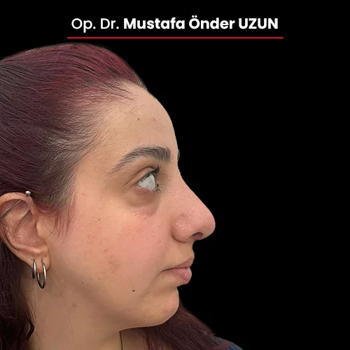 Öncesi Sonrası 1399603713