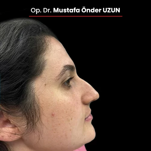 Öncesi Sonrası 1668357277