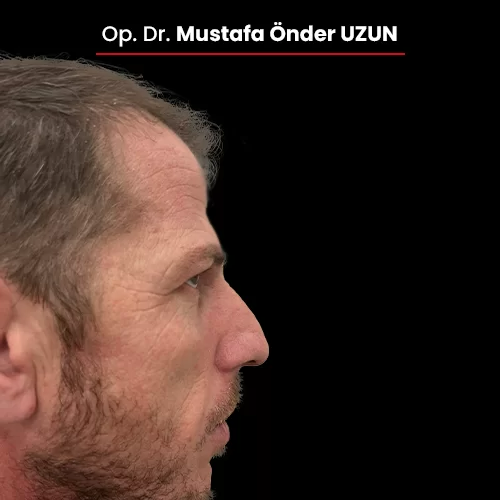 Öncesi Sonrası 342691060