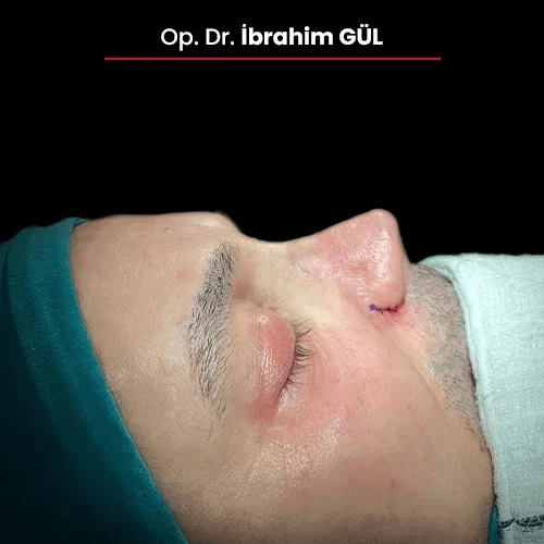 Öncesi Sonrası 1727878578