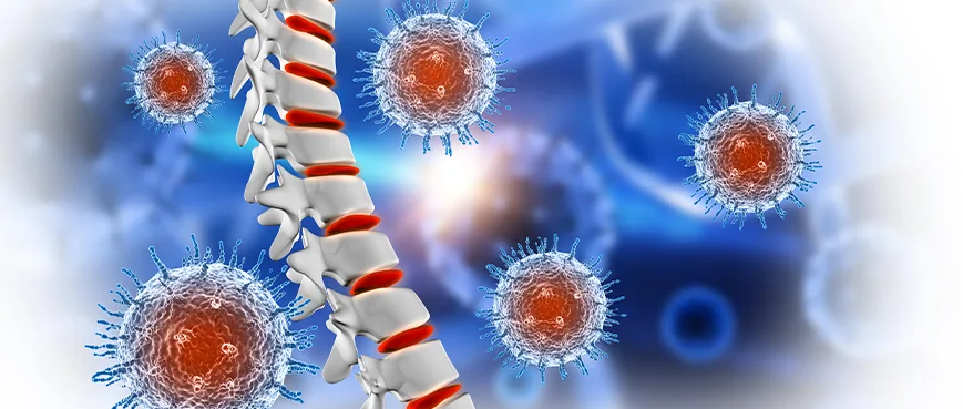 BONE AND SOFT TISSUE TUMORS: SYMPTOMS, DIAGNOSIS AND TREATMENT