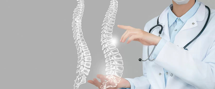 Spinal Stenosis (Narrowing of the Spinal Canal)
